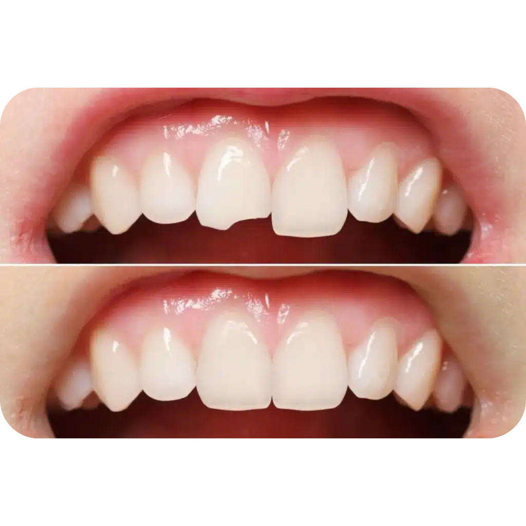 Resumo visual da Mentoria RC360 para dentistas que trabalham com resina composta